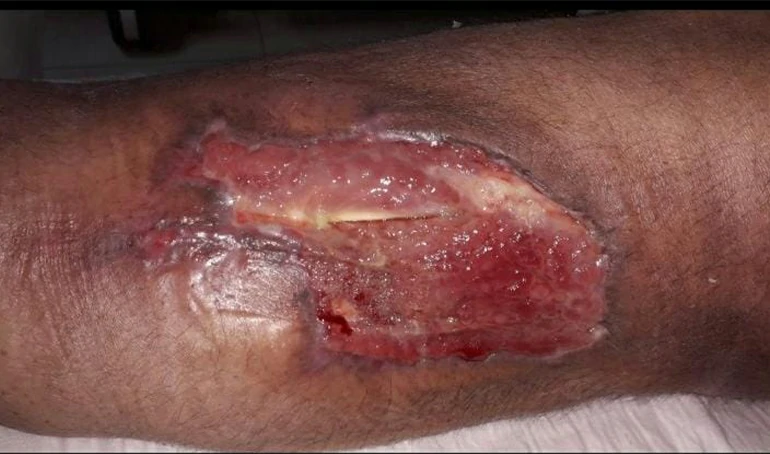 logo clinica de heridas